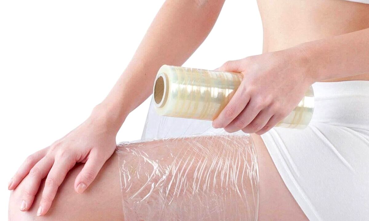 procedure